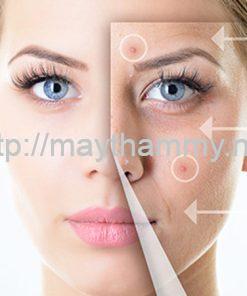 Máy triệt lông SHINY