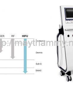 Máy nâng cơ Ultraskin