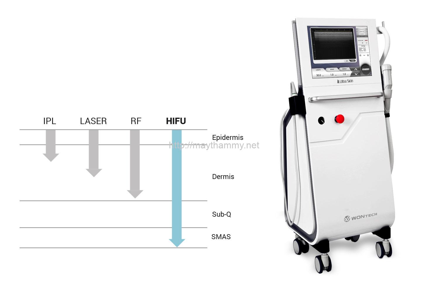 hieu-thiet-bi-nang-co-nhu-chuyen-gia-2 Máy nâng cơ Ultraskin